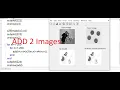 Add 2 Images in MATLAB by imadd and Without inbuilt function by Rohit Arora sir