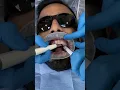Download Lagu GBT Airflow Dental Hygiene Treatment Stain Removal