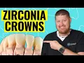 Zirconia Crowns for your Teeth Dentist Explains the Truth