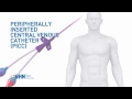 Learn About the Peripherally Inserted Central Venous Catheter PICC