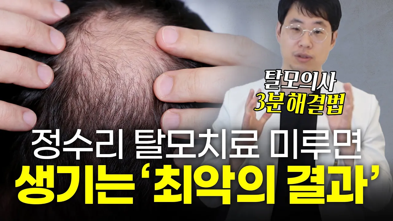 정수리 탈모치료 계속 미루면 생기는 최악의 결과 "후회하기 전에 하세요"ㅣ뉴헤어