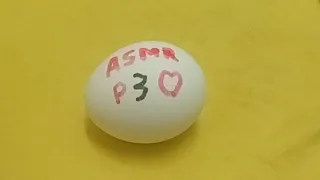 කොහොමද සෙට් එක