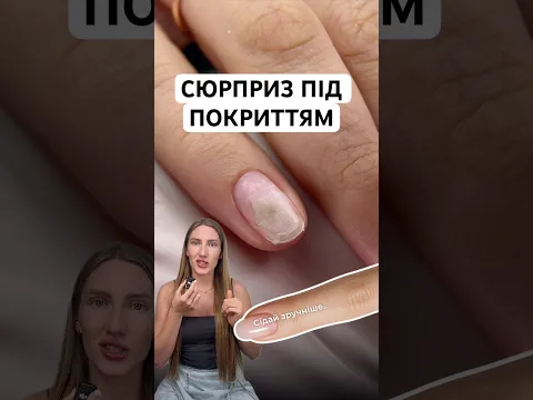 Це точно не грибок? 🍄💅 | Псевдомонія/синьогнійка | хто винен за сюрпризи під покриттям