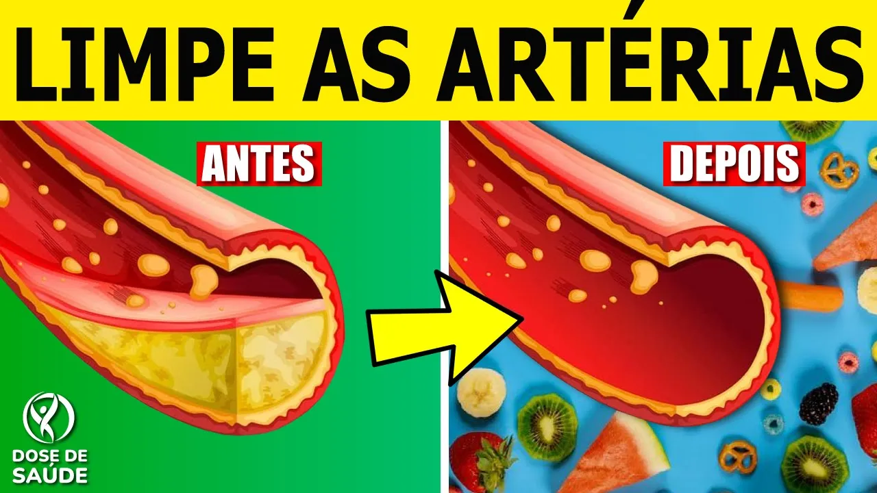 Estes 7 alimentos LIMPAM suas artérias e podem prevenir um ataque cardíaco (desobstrua as artérias)