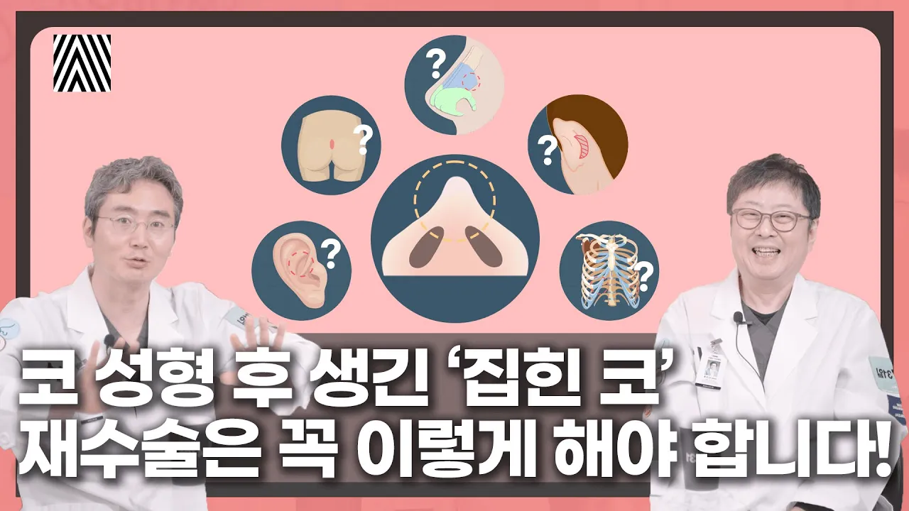 코 성형 후 생긴 '집힌 코' 재수술의 정답은?!! 집힌 코 2편_[4월31일 성형외과]
