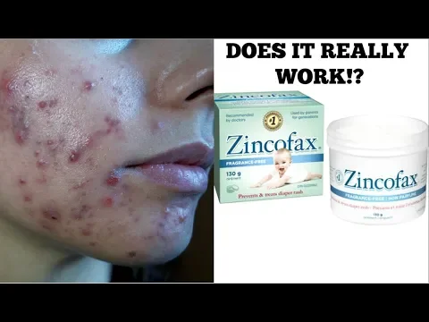 Download MP3 TESTING BABY BUTT CREAM FOR ACNE!? || Does this really work?
