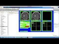 Image Compression Brain Image using Matlab