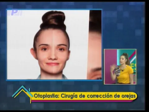 Estética al Día: Otoplastia Cirugía de corrección de orejas 