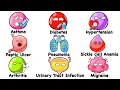 Every Common Disease Explained in 13 Minutes