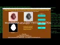 Skin Disease Detection Using Python Opencv Machine Learning Deep Learning Skin Disease Predict