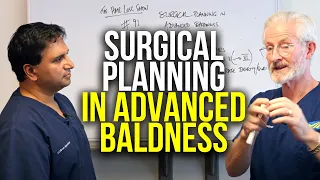 Case Study: Surgical Planning in Advanced Baldness