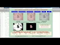 Skin Disease Detection Using Image Processing With Source Code Matlab Project