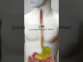 3 Types of Reflux (GERD, LPR, non-acidic LPR) #shorts @fauquierent