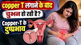 Copper T लगाने के बाद चुभन हो रही है क्या करें? Copper t Side effect.Copper t se Discomfort ho raha.