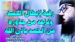 رقية لابطال الحسد ونزعه من جذوره من الجسد بإذن الله رضوان الراقي المراكشي 0600261900 0666778582 