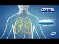 Treating Excess Mucus With Mucinex Living Well