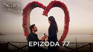 Scars Of The Soul Episode 77 Alaca English Subtitles 