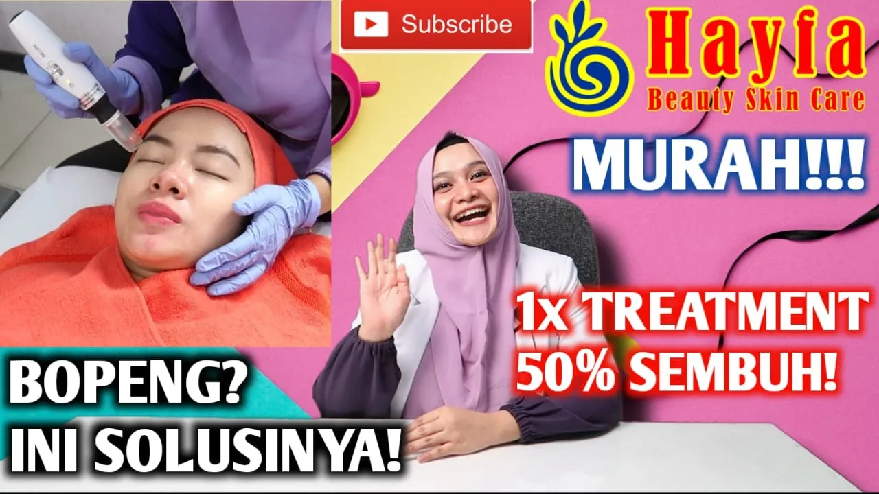 obatmatapanda #solusimatapanda #matapanda #perawatanmatapanda #teratmentmatapanda #Adiba Assegaf Vid. 