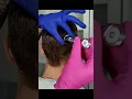 Download Lagu Hair \u0026 scalp tests