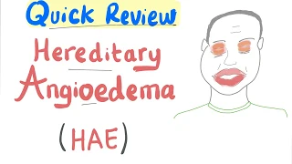 Hereditary Angioedema HAE Quick Review Emergency Medicine 