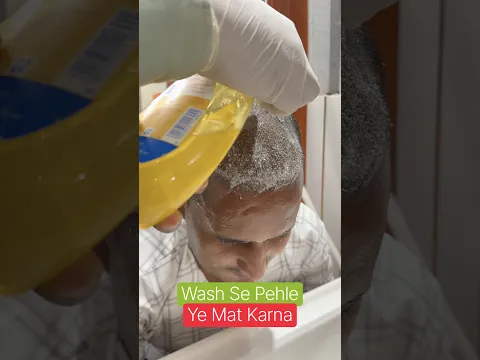 Wash Se Pehle Ye 3 Galti Mat Karna ❌ Grafts Nikal Jayenge! #shorts #headwash #hairtransplant