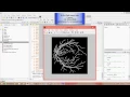 ANALYSIS OF RETINAL BLOOD VESSELS USING IMAGE PROCESSING TECHNIQUES