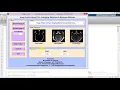 Image Fusion Using PCA on MRI and CT Image Full Matlab Project Code