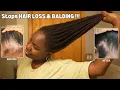 Download Lagu Use This Once a Week and Your Hair Will Never Stop Growing| DIY for HAIR LOSS \u0026 BALDING‼️