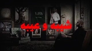 وحيده   شيبه عيبه   سلومو                           دندنها
