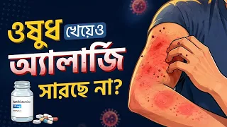 বেগুন খেলেই কি সারা শরীর চুলকায়? অ্যালার্জির কারণ, লক্ষণ ও প্রতিকার | Allergy Symptom & Cure #health
