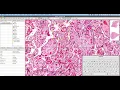 Creating annotations in Qupath