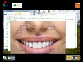 Smile and eye detection in Python OpenCV with HaarCascade Classifier