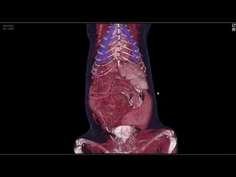 動物CT腹腔成像