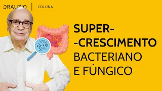 Sinais de que seu intestino está em desequilíbrio