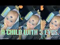 Download Lagu Three eye baby. Three eye baby born in Germany