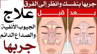 علاج السحر المشموم والجيوب الانفيه والصداع الدائم جربها بنفسك سهلة وبسيطة  علاج السحر المشموم والجيوب الانفيه والصداع الدائم جربها بنفسك سهلة وبسيطة