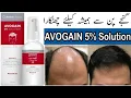 AVOGAIN 5 Solution Uses in Urdu How to Use AVOGAIN Solution Side Effects
