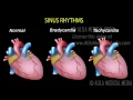 Cardiac Arrhythmias, Animation