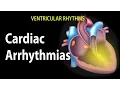 Download Lagu Cardiac Arrhythmias, Animation