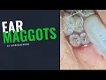 Download Lagu EAR MAGGOTS (COMPLETE VIDEO - FULL TREATMENT)