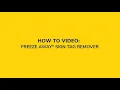 How to Use Dr Scholl s Freeze Away Skin Tag Remover