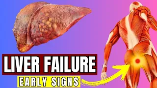 Download Recognizing Liver Disease: Signs, Symptoms, and Home Remedies\ MP3