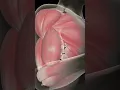 Muscle Hypertrophy Explained What Makes Muscle Grow