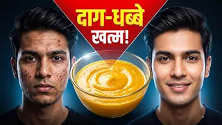 पिगमेंटेशन दूर करने के 5 असरदार घरेलू नुस्खे | Best Home Remedies for Dark Spots