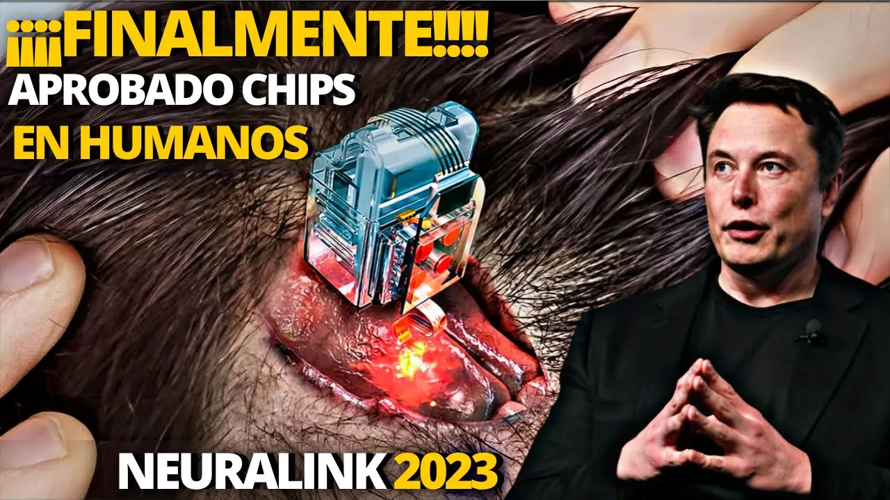 Elon Musk recibe autorización para poner chips en humanos| Hombre volvió a caminar tras recibir chip