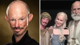 Game of Thrones and EastEnders actor Darren Kent dies aged 36 after long health battle