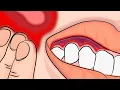 How to Stop your Toothache Pain INSTANTLY and Naturally