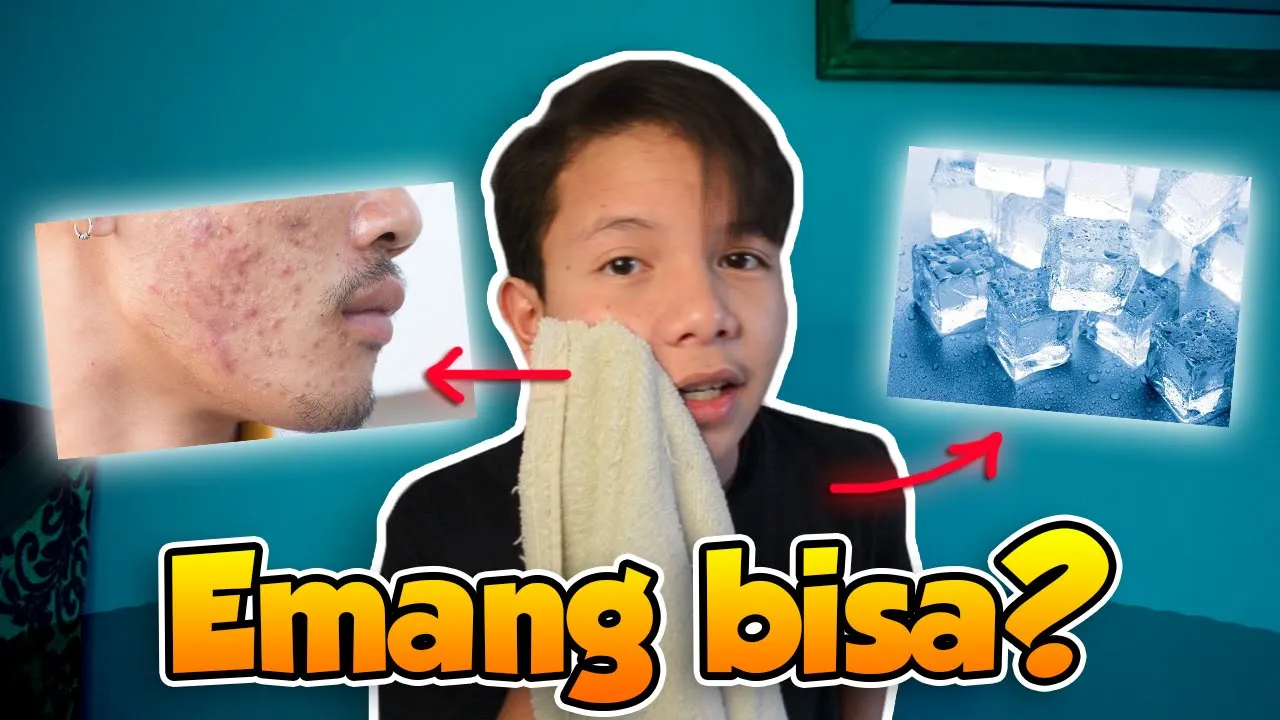 ES BATU UNTUK WAJAH?! | BENER GA SIH BISA HILANGIN KOMEDO DAN JERAWAT. 