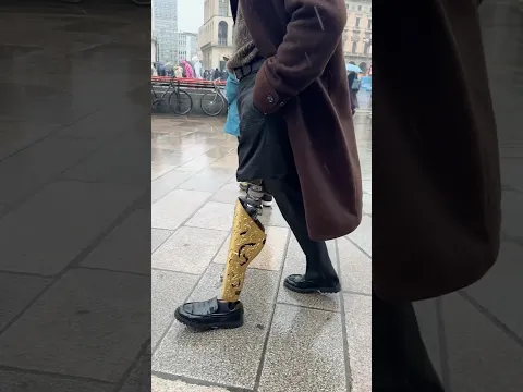 Turning my Prosthetic Leg into ART