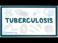 Download Lagu Tuberculosis - causes, symptoms, diagnosis, treatment, pathology